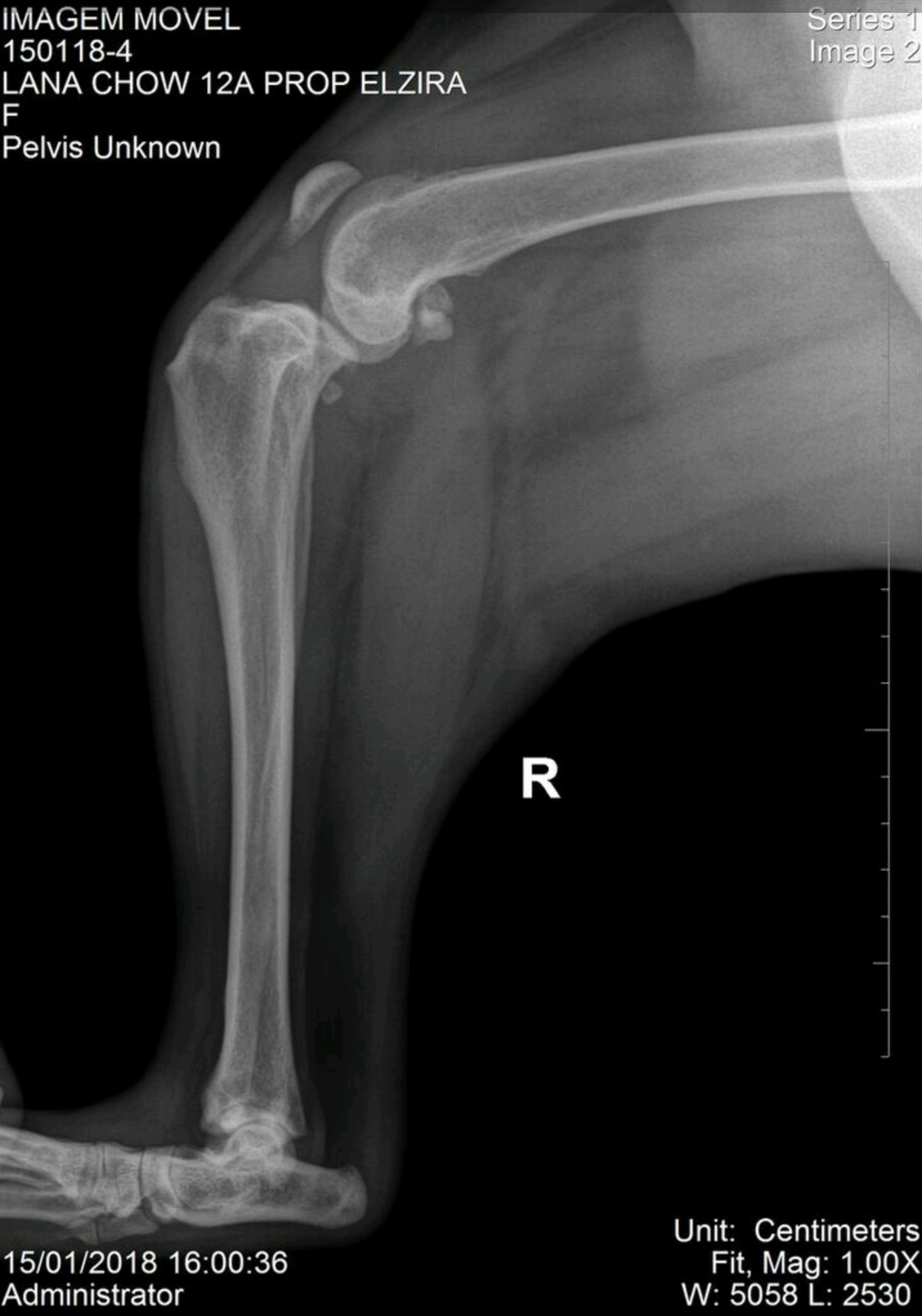 Ruptura de Ligamento Cruzado Cranial (RLCCd)